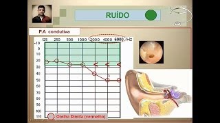 Videoaula  8 Parte 2  Riscos físicos RUÍDO  PAIRO [upl. by Lyreb]