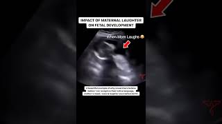 Effect of a Mothers Laughter on an Unborn Baby [upl. by Gurtner44]