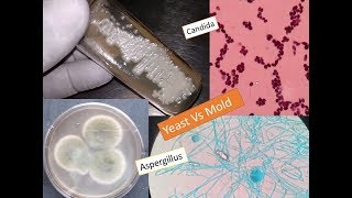 Study of fungi  Yeast and mold [upl. by Eisej]