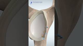 BEST treatment for SHOULDER dislocation telugu  Dr Sharath Babu Nilagiri  shoulderdislocation [upl. by Rogers]