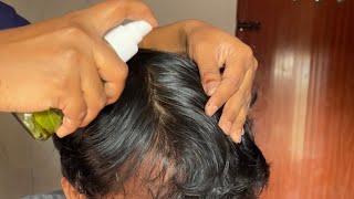 dandruff Permanent Solution use this spray dandruff homeremedies haircare haircaretips [upl. by Hayikaz]