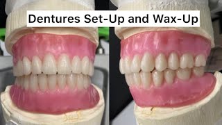 How to SetUp and Festoon Dentures Efficiently [upl. by Alina459]