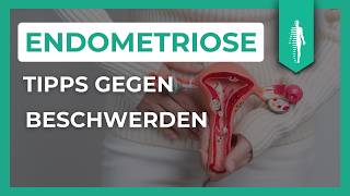 Pille Schmerzmittel amp Alternativen Die besten Tipps für Endometriose und Adenomyose [upl. by Ainoyek451]