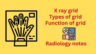 x ray grid types of grid function of gridradiology notes [upl. by Glenn922]