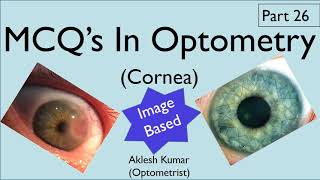 MCQ’s in Optometry  Cornea  Diseases of Cornea  Part 26 [upl. by Nevs885]