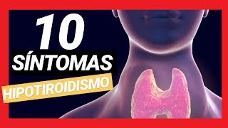 10 SIGNOS Y SÍNTOMAS DE HIPOTIROIDISMO  GLÁNDULA TIROIDES [upl. by Yorle]