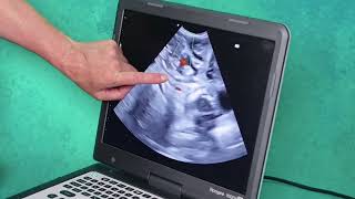 Cord insertion shown on canine pregnancy scan [upl. by Nirda]