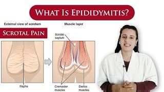 What is Epididymitis  causes symptoms treatment  scrotal pain  By Dr N Joshi [upl. by Theta737]