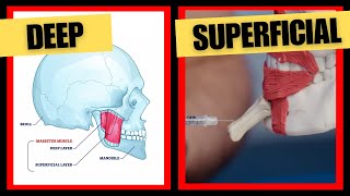 The Best Lower Face Botox Injection Depths  Botox Injection Depth Guide [upl. by Kolodgie]