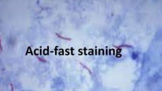 Respiratory microbiology  Acid fast staining microbiology staining mycobacteria [upl. by Oirazan]