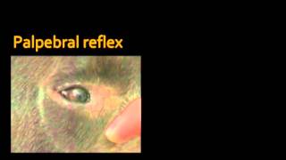 Palpebral and corneal reflexes [upl. by Nerradal805]