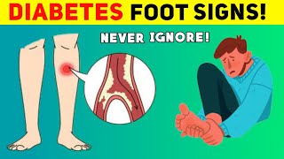 10 Alarming Signs of Diabetes Foot Complications  MindfulCure [upl. by Bo670]