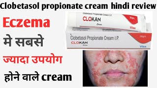 Clobetasol propionate cream ip  Clobetasol propionate cream ip uses in hindi  clokan cream hindi [upl. by Olonam]