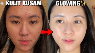 5 CARA AMPUH Untuk KULIT CERAH amp GLOWING✨  Dari Kusam jadi Glowing 🌟 [upl. by Ennire]