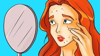 10 Miti Sull’Acne A Cui Fare Attenzione [upl. by Delfeena]