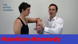 HawkinsKennedy Shoulder Pain Impingement Test [upl. by Salokin]