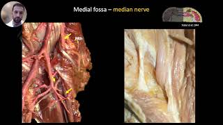 ANTERIOR ELBOW SONOANATOMY [upl. by Sayer]