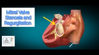 Mitral valve stenosis and Mitral valve regurgitation I Human Anatomy Tutorial [upl. by Celestyna]