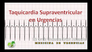 Taquicardia Supraventricular en Urgencias [upl. by Fricke]