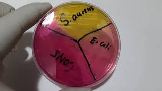 Mannitol Salt Agar  MSA with growth of Staphylococcus aureus CoNS and E coli [upl. by Earised]