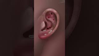 ASMR getting parasites out of a ear [upl. by Pelligrini]