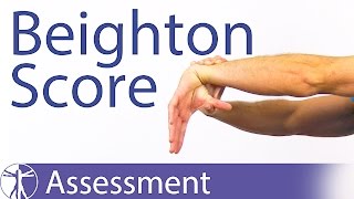 The Beighton Score  Generalized Joint Hypermobility Laxity [upl. by Ennairb]