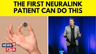 Neuralink News  Elon Musk  First Neuralink Patient Able to Control Mouse With Thoughts  N18V [upl. by Elna238]