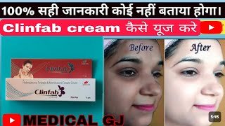 Clinfab cream uses in hindi  clinfab cream  क्लिनफैब क्रीम  दाग धब्बे मिटाने की क्रीम  Clinfab [upl. by Kobe]