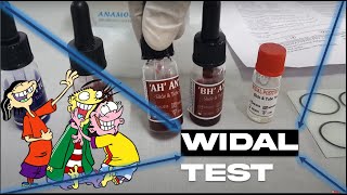 WIDAL TEST  SLIDE AGGLUTINATION TEST  TYPHOID FEVER  MICROBIOLOGY  MBBS  REVISION [upl. by Yeo]