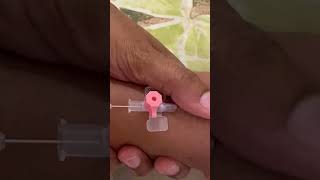 IV cannula insertiondoctornursingknowledgeshortvideoviralvedio [upl. by Tewell374]