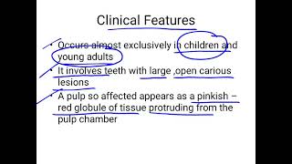 chronic hyperplastic pulpitis [upl. by Alliw]