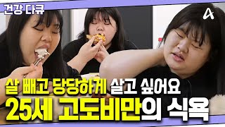 건강다큐 살이 쪄서 우울하지만 참을 수 없는 식욕  90kg 고도비만이 된 25세 여성 [upl. by Rim]