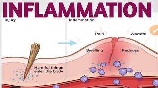 INFLAMMATION  TYPES  CAUSES  PATHOPHYSIOLOGY  SYMPTOMS  TREATMENT [upl. by Marthe269]