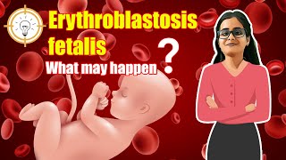 Erythroblastosis fetalis I One Concept I Rh positive baby amp Rh negative mother  What may happen [upl. by Vange134]