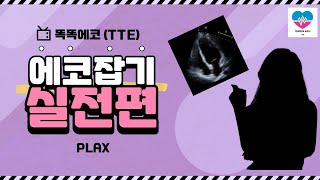 Parasternal long axis view 잡기 심장초음파 실전편 1탄 echocardiography 심장초음파 초음파 plax rdcs sonography [upl. by Merill]