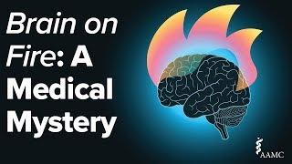 Brain on Fire A Medical Mystery [upl. by Halyk]