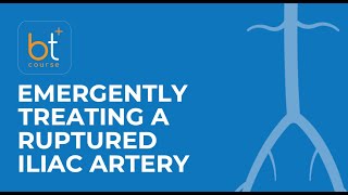 Course Preview Emergently Treating a Ruptured Iliac Artery [upl. by Esiouqrut741]