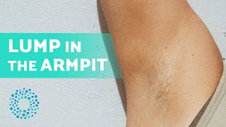 PAINFUL LUMP Under the ARM 6 Causes 💥 Painful Armpit Lump [upl. by Calandria]