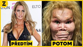 15 Celebrit Kterým Plastická Chirurgie Dopadla Katastrofou [upl. by Werdn300]