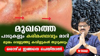 മുഖത്തെ പാടുകളും കരിമംഗലവും മാറി മുഖം വെളുത്തു കവിളുകൾ തുടുക്കും karimangalam treatment in malayalam [upl. by Lambert]