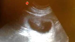 Golden Retriever Ultrasound  Day 30 [upl. by Aisya]