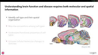 Unveiling Brain Complexity with the MERSCOPE® Platform Using 1000plex Gene Panels [upl. by Jaynell]