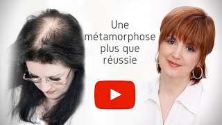 Métamorphose  Perte partielle des cheveux [upl. by Dumond]