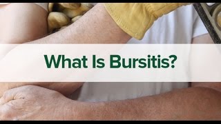 BURSITIS  Patient Education Video [upl. by Kalikow967]