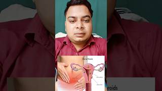 Treatment of fibroids in uterus at home fibroid trending [upl. by Epuladaugairam782]