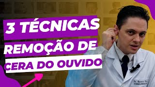 🔥Como é a remoção de cera do ouvido no Consultório Otorrino explica [upl. by Vi]