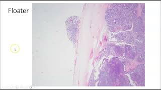 Artifacts in Histopathology and Cytopathology [upl. by Nellir]