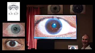 Snippets Iridology Online Course [upl. by Ruosnam]