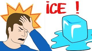 How To Stop A Migraine With ICE immediately [upl. by Eatnoj]