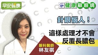 針眼惱人！眼科醫師：這樣處理才不會反覆長膿包【眼科醫師 林友祺／健康顧眼睛】 [upl. by Bohlin]